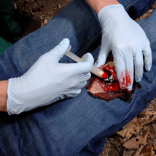 Аппликатор гемостатический с гранулами Rhino Rescue в Щелково хитозановый